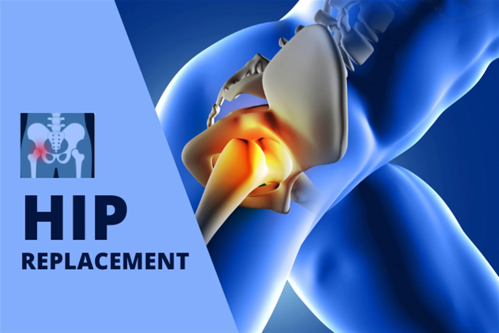 hip replacement surgeon in delhi